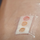 Without pricking your finger: laser patch will tell you about your health status during diabetes