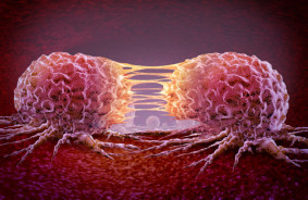 US researchers have developed a molecule that makes cancer cells kill themselves